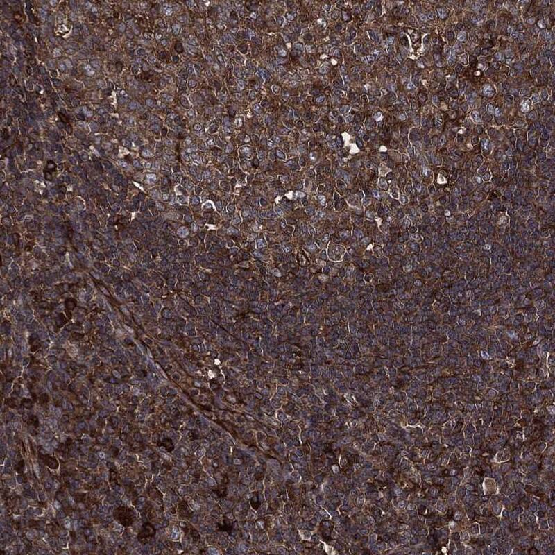 RAP1GDS1 Antibody Immunohistochemistry-Paraffin: RAP1GDS1 Antibody [NBP3-25093]