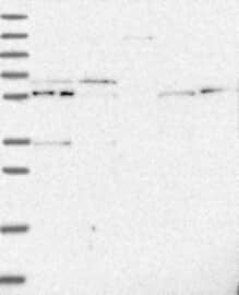 RAP1GDS1 Antibody Western Blot: RAP1GDS1 Antibody [NBP3-25093]