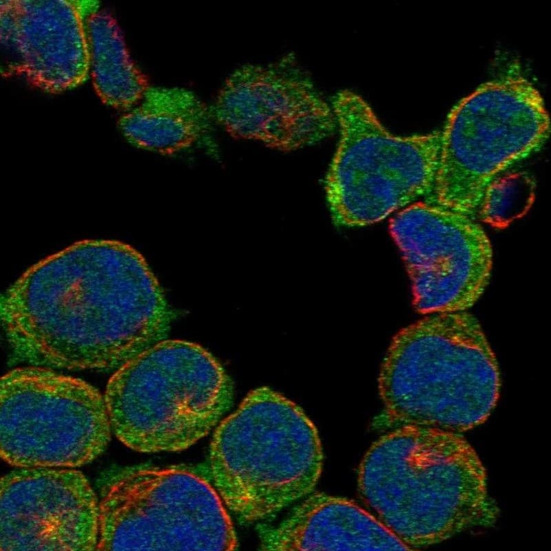 RASGRP3 Antibody Immunocytochemistry/Immunofluorescence: RASGRP3 Antibody [NBP3-25094]