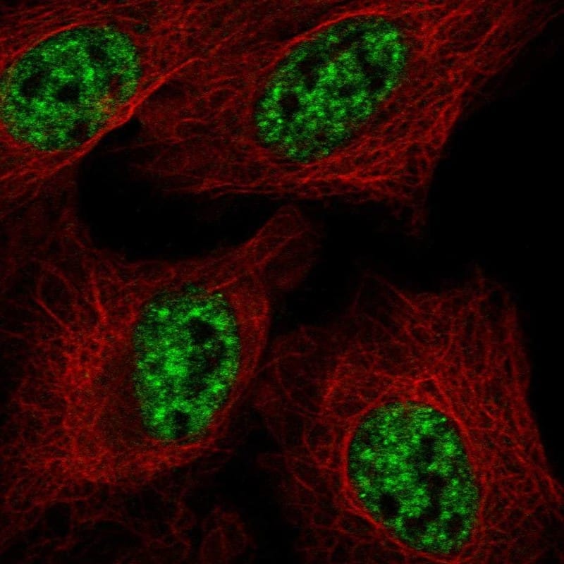 RBMY1F Antibody Immunocytochemistry/Immunofluorescence: RBMY1F Antibody [NBP3-25097]