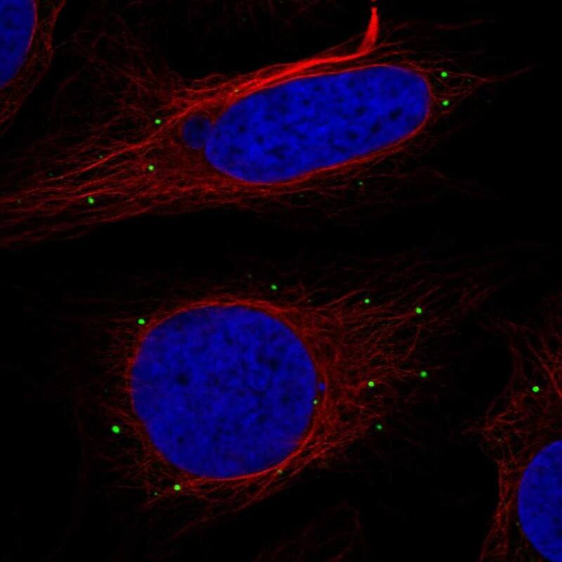 Reticulon 2 Antibody Immunocytochemistry/Immunofluorescence: Reticulon 2 Antibody [NBP3-25099]