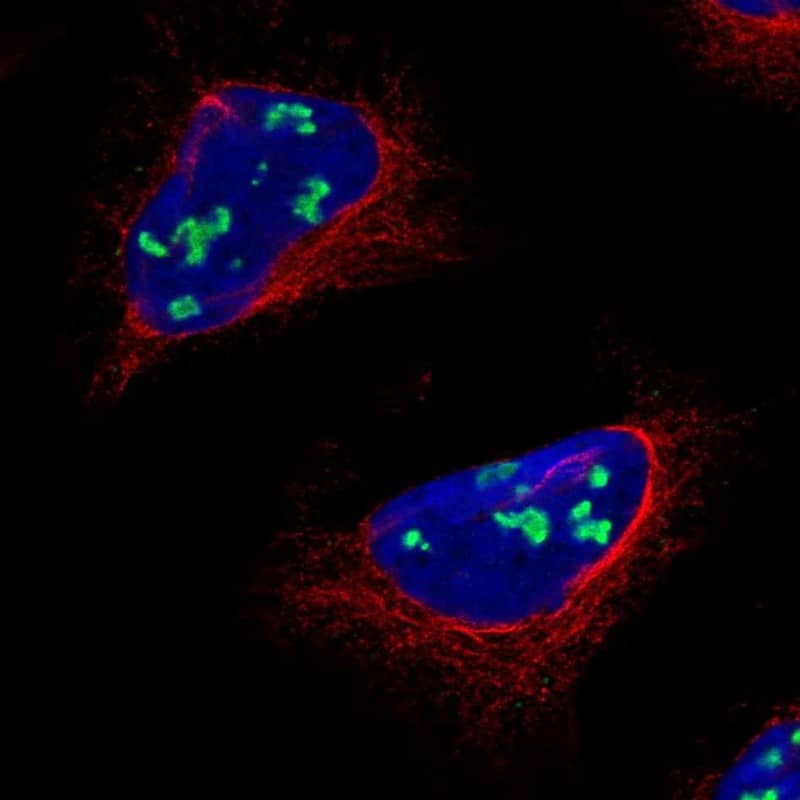 REV1 Antibody Immunocytochemistry/Immunofluorescence: REV1 Antibody [NBP3-25100]