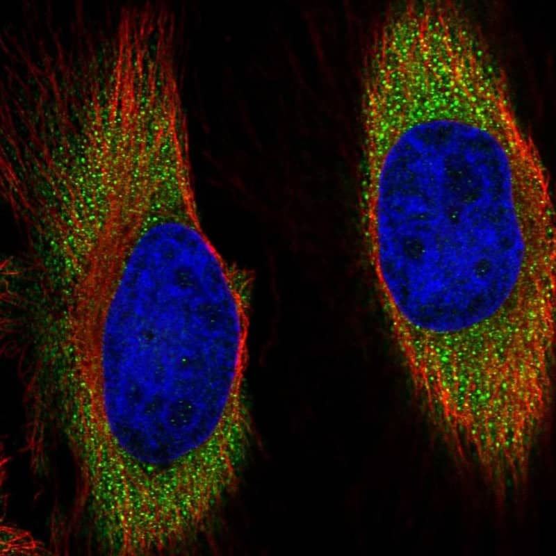 RGR Antibody Immunocytochemistry/Immunofluorescence: RGR Antibody [NBP3-25103]