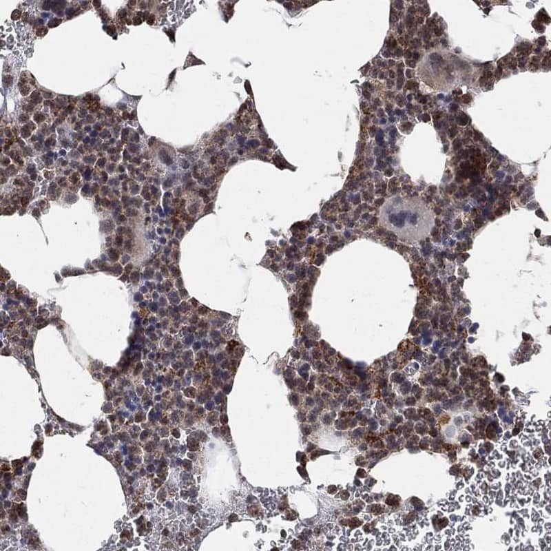 RIN3 Antibody Immunohistochemistry-Paraffin: RIN3 Antibody [NBP3-25104]