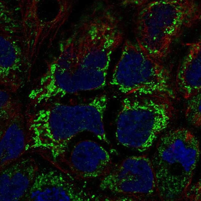 RIP5 Antibody Immunocytochemistry/Immunofluorescence: RIP5 Antibody [NBP3-25105]