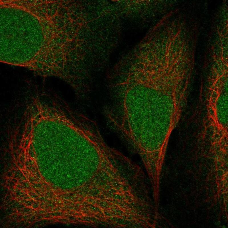 Rit2 Antibody Immunocytochemistry/Immunofluorescence: Rit2 Antibody [NBP3-25106]