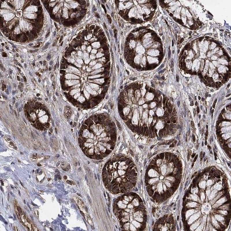 RNase L Antibody Immunohistochemistry-Paraffin: RNase L Antibody [NBP3-25108]