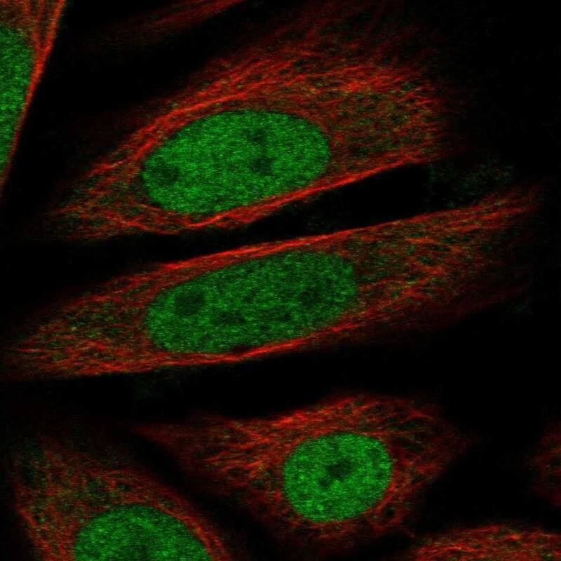 RNF20 Antibody Immunocytochemistry/Immunofluorescence: RNF20 Antibody [NBP3-25109]