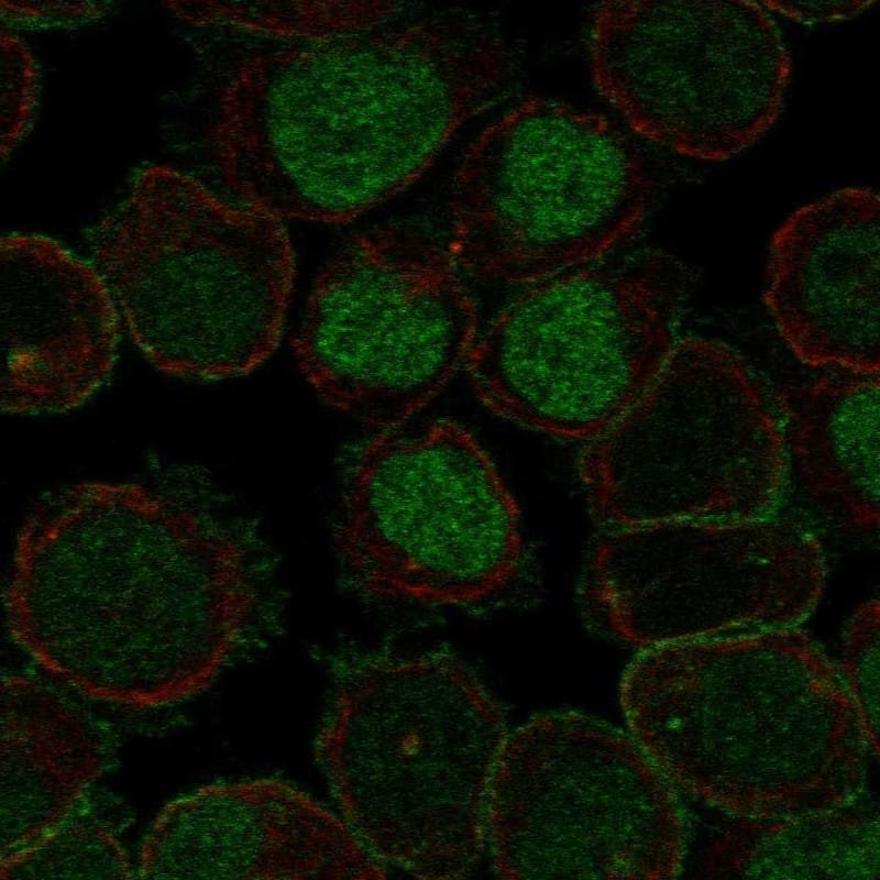 ROBO2 Antibody Immunocytochemistry/Immunofluorescence: ROBO2 Antibody [NBP3-25111]