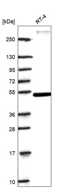 ROR alpha/NR1F1 Antibody Western Blot: ROR alpha/NR1F1 Antibody [NBP3-25112]