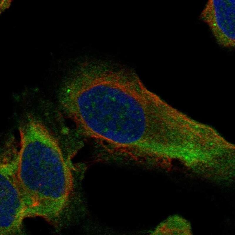 RPL10A Antibody Immunocytochemistry/Immunofluorescence: RPL10A Antibody [NBP3-25113]