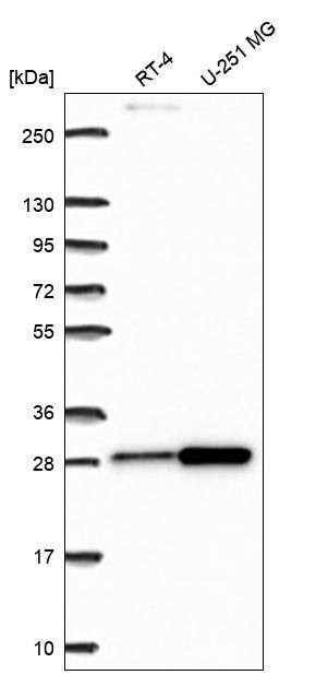 RPL10A Antibody Western Blot: RPL10A Antibody [NBP3-25113]