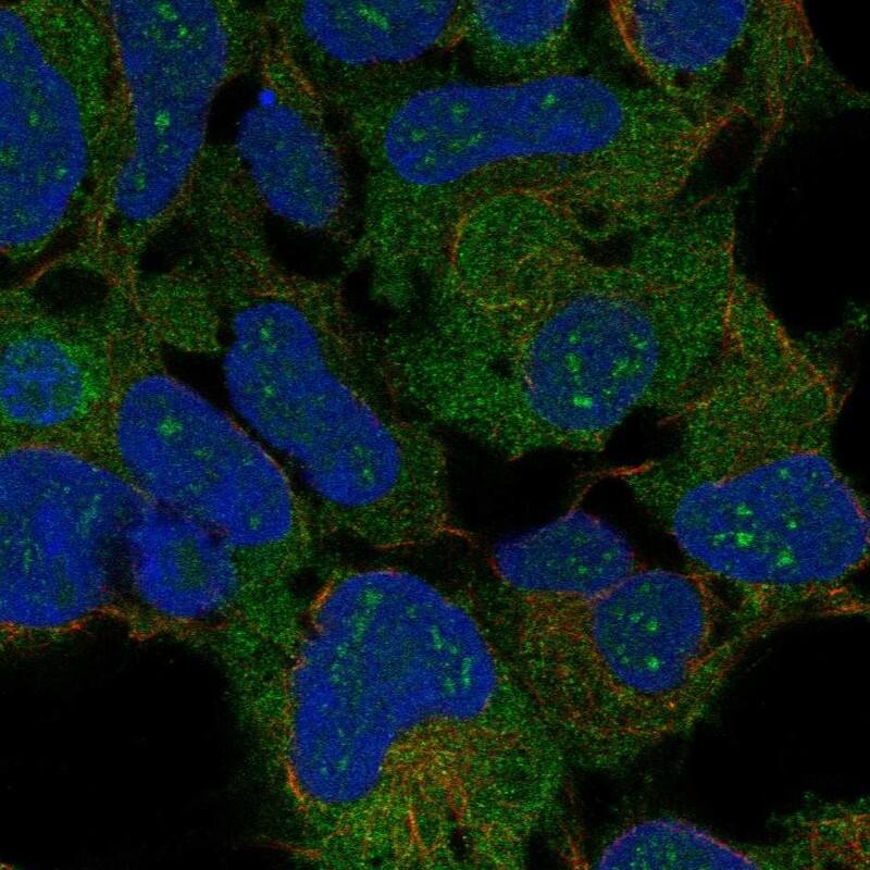 RPLP2 Antibody Immunocytochemistry/Immunofluorescence: RPLP2 Antibody [NBP3-25114]