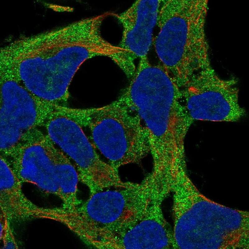 RPS11 Antibody Immunocytochemistry/Immunofluorescence: RPS11 Antibody [NBP3-25115]