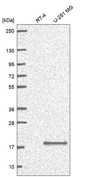 RPS23 Antibody Western Blot: RPS23 Antibody [NBP3-25116]