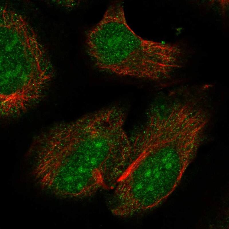 RXR beta/NR2B2 Antibody Immunocytochemistry/Immunofluorescence: RXR beta/NR2B2 Antibody [NBP3-25117]