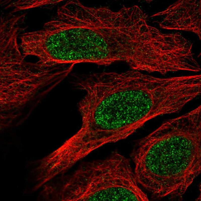 RXR beta/NR2B2 Antibody Immunocytochemistry/Immunofluorescence: RXR beta/NR2B2 Antibody [NBP3-25118]