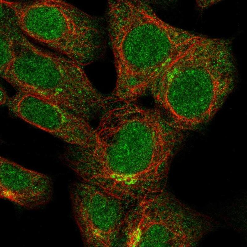 Saitohin Antibody Immunocytochemistry/Immunofluorescence: Saitohin Antibody [NBP3-25119]