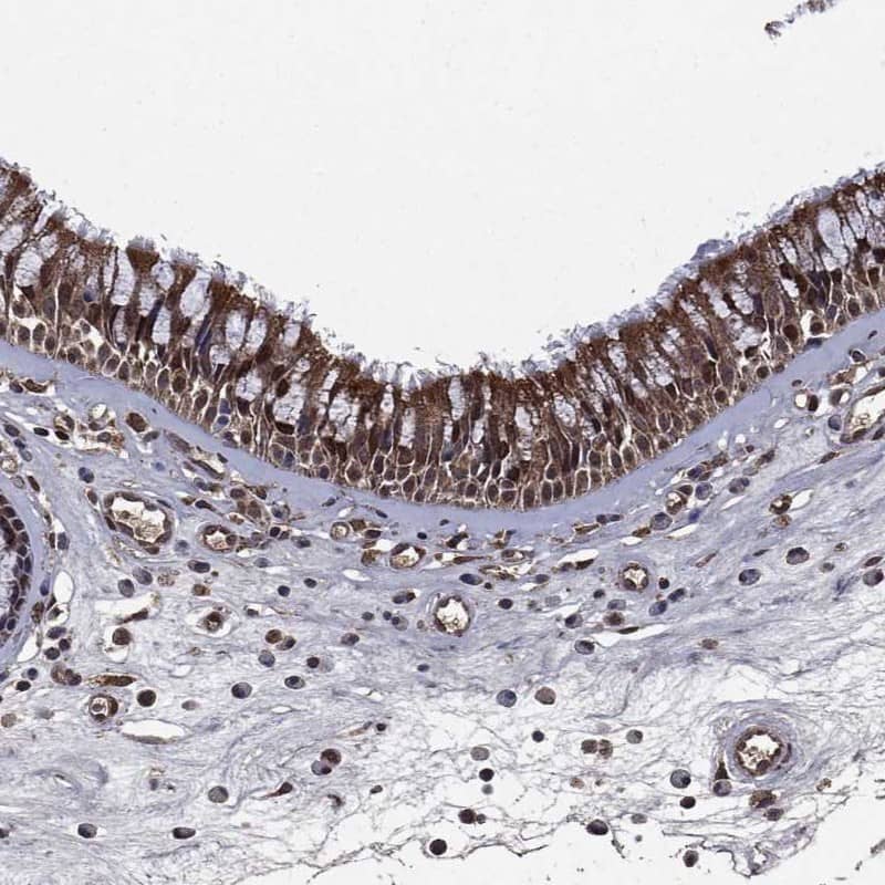 SAPS2 Antibody Immunohistochemistry-Paraffin: SAPS2 Antibody [NBP3-25120]