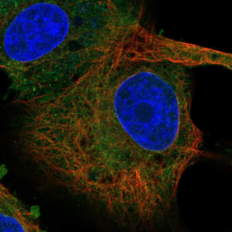 SC4MOL Antibody Immunocytochemistry/Immunofluorescence: SC4MOL Antibody [NBP3-25121]