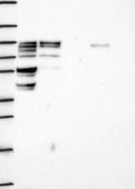 SCY1 like 3 Antibody Western Blot: SCY1 like 3 Antibody [NBP3-25122]