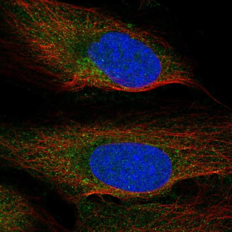 SEC22L2 Antibody Immunocytochemistry/Immunofluorescence: SEC22L2 Antibody [NBP3-25125]