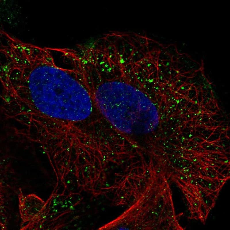 SEMA3D Antibody Immunocytochemistry/Immunofluorescence: SEMA3D Antibody [NBP3-25128]