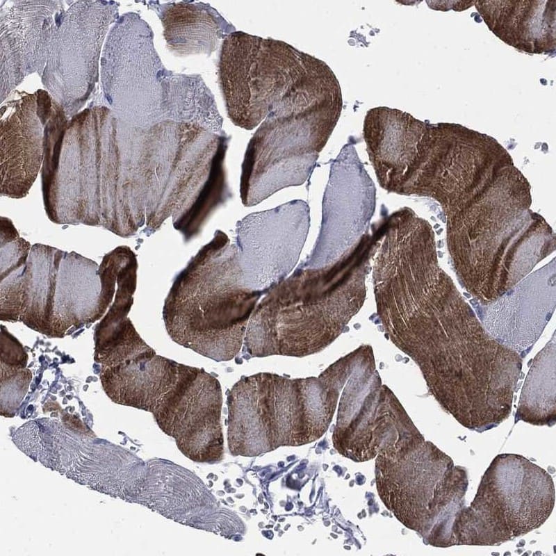 SERCA1 ATPase Antibody Immunohistochemistry-Paraffin: SERCA1 ATPase Antibody [NBP3-25129]