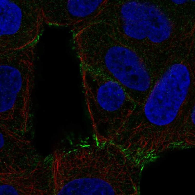 Serine Palmitoyltransferase 2 Antibody Immunocytochemistry/Immunofluorescence: Serine Palmitoyltransferase 2 Antibody [NBP3-25130]