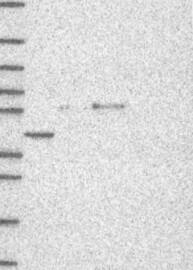 Serpin A4/Kallistatin Antibody Western Blot: Serpin A4/Kallistatin Antibody [NBP3-25131]