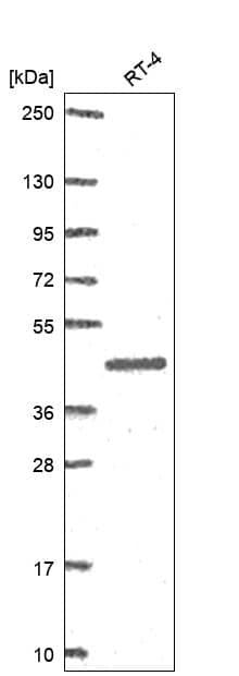 SerpinB2 Antibody Western Blot: SerpinB2 Antibody [NBP3-25132]