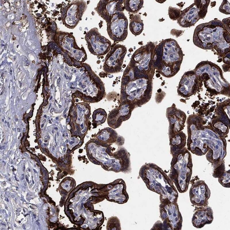SerpinB2 Antibody Immunohistochemistry-Paraffin: SerpinB2 Antibody [NBP3-25132]