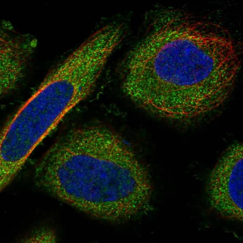 SERPINB4 Antibody Immunocytochemistry/Immunofluorescence: SERPINB4 Antibody [NBP3-25133]