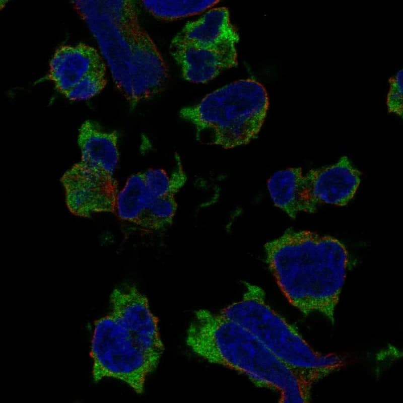 SH2D1A Antibody Immunocytochemistry/Immunofluorescence: SH2D1A Antibody [NBP3-25134]