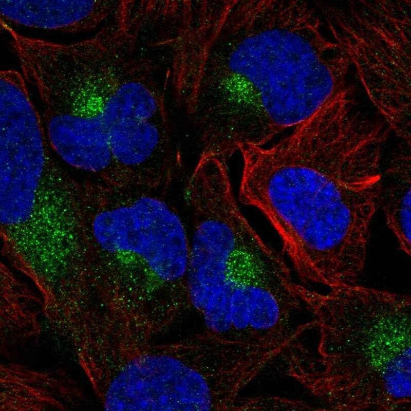 SH3BGRL Antibody Immunocytochemistry/Immunofluorescence: SH3BGRL Antibody [NBP3-25135]