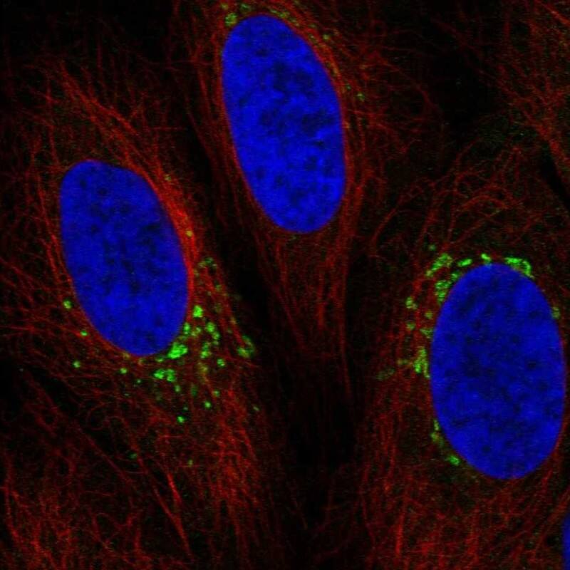 SH3BP2 Antibody Immunocytochemistry/Immunofluorescence: SH3BP2 Antibody [NBP3-25136]