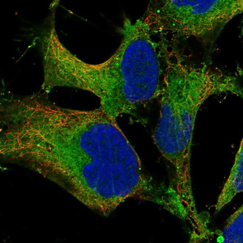 SH3PXD2B Antibody Immunocytochemistry/Immunofluorescence: SH3PXD2B Antibody [NBP3-25137]