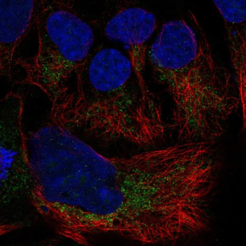 SLC25A19 Antibody Immunocytochemistry/Immunofluorescence: SLC25A19 Antibody [NBP3-25141]