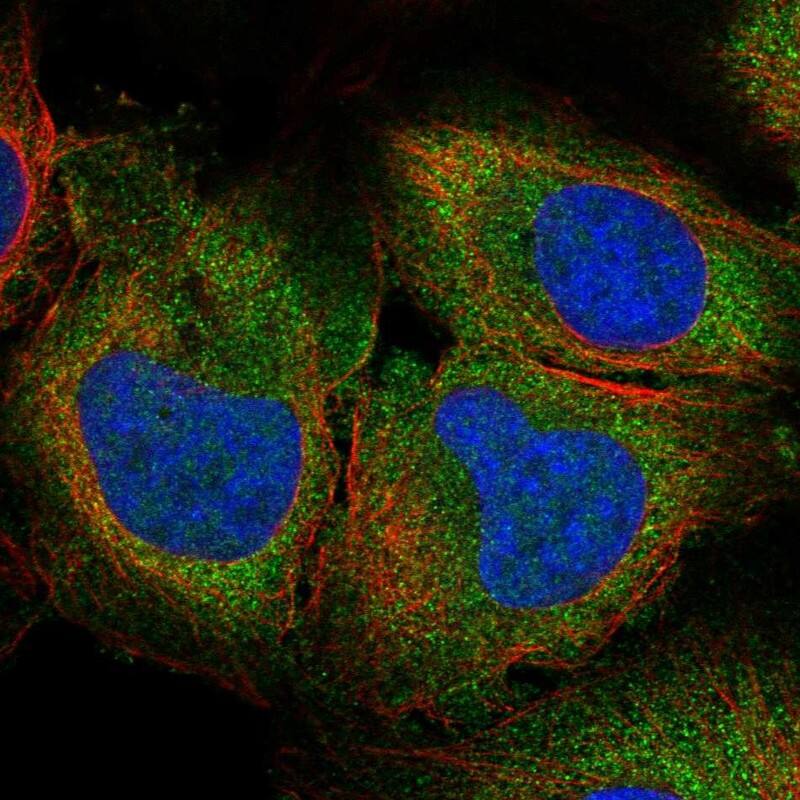 SLC25A45 Antibody Immunocytochemistry/Immunofluorescence: SLC25A45 Antibody [NBP3-25142]