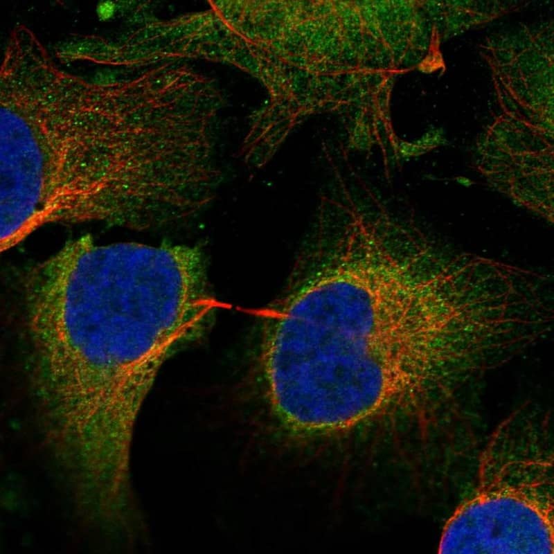 SLC38A2 Antibody Immunocytochemistry/Immunofluorescence: SLC38A2 Antibody [NBP3-25144]