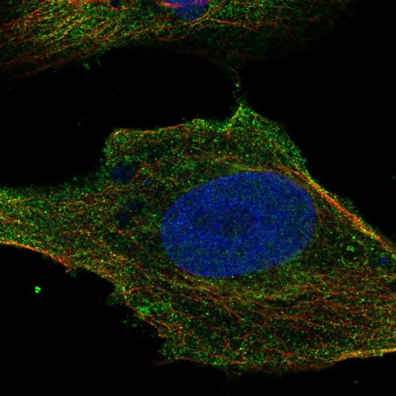 SLC6A7 Antibody Immunocytochemistry/Immunofluorescence: SLC6A7 Antibody [NBP3-25145]