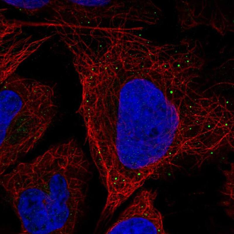 SLITRK5 Antibody Immunocytochemistry/Immunofluorescence: SLITRK5 Antibody [NBP3-25146]