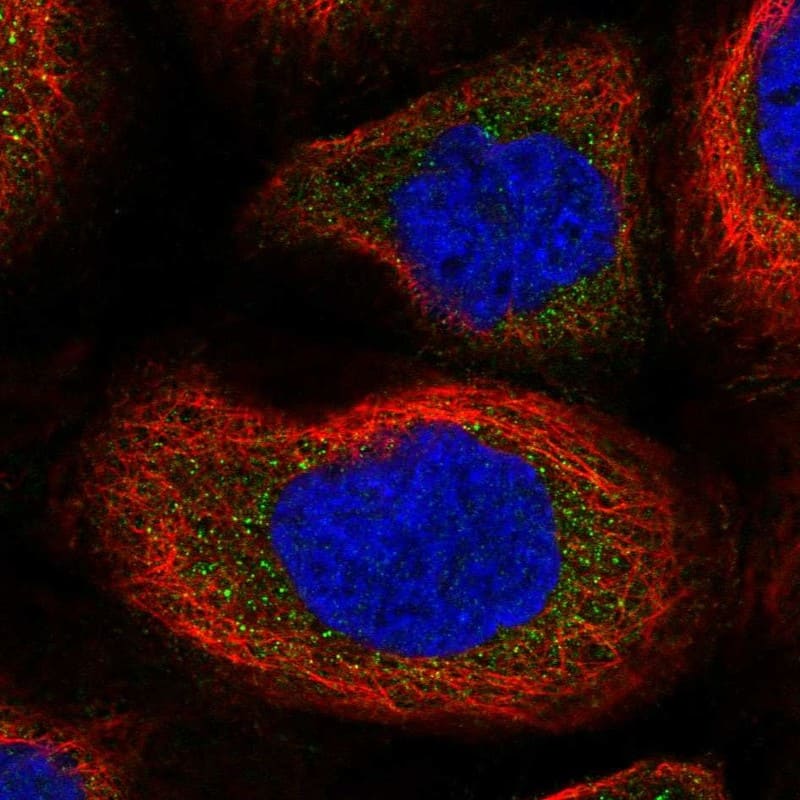 SLK Antibody Immunocytochemistry/Immunofluorescence: SLK Antibody [NBP3-25147]