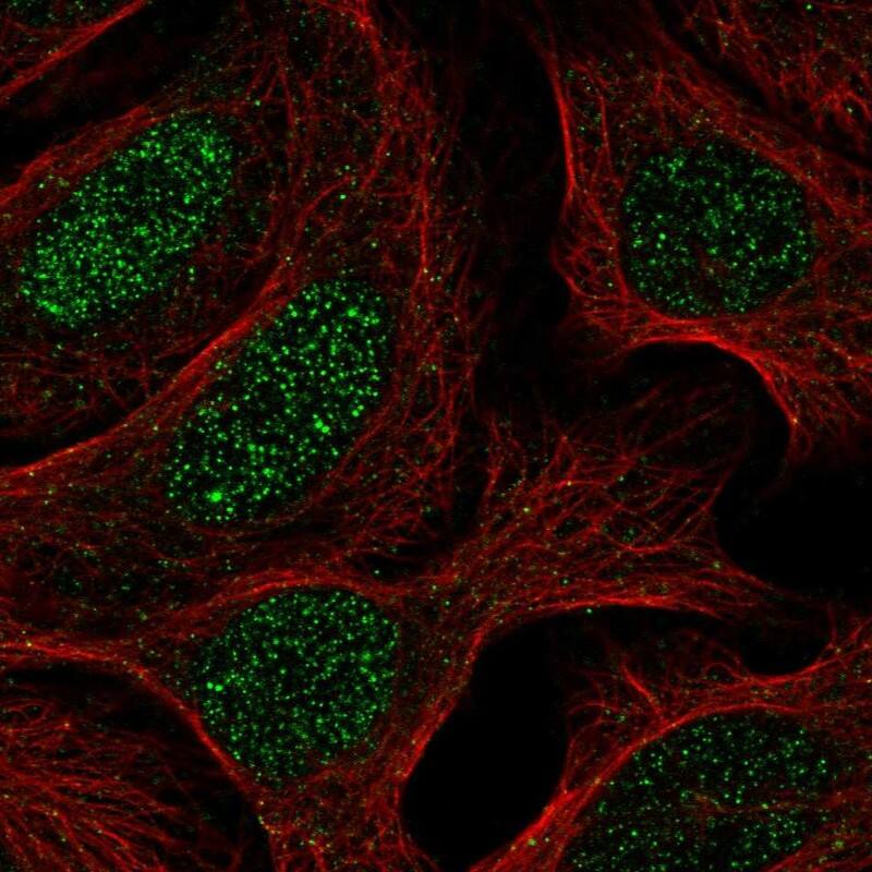 SNAPC4 Antibody Immunocytochemistry/Immunofluorescence: SNAPC4 Antibody [NBP3-25148]