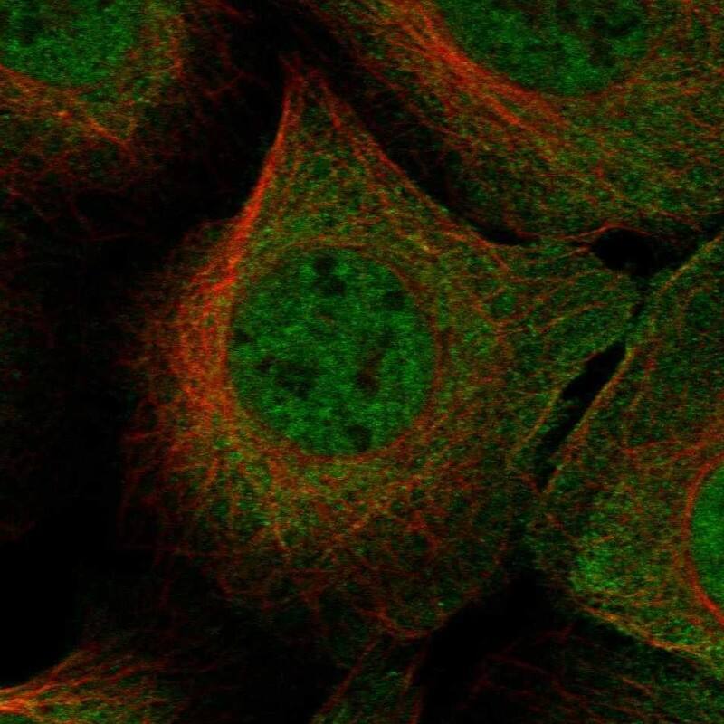 SNURPORTIN1 Antibody Immunocytochemistry/Immunofluorescence: SNURPORTIN1 Antibody [NBP3-25149]