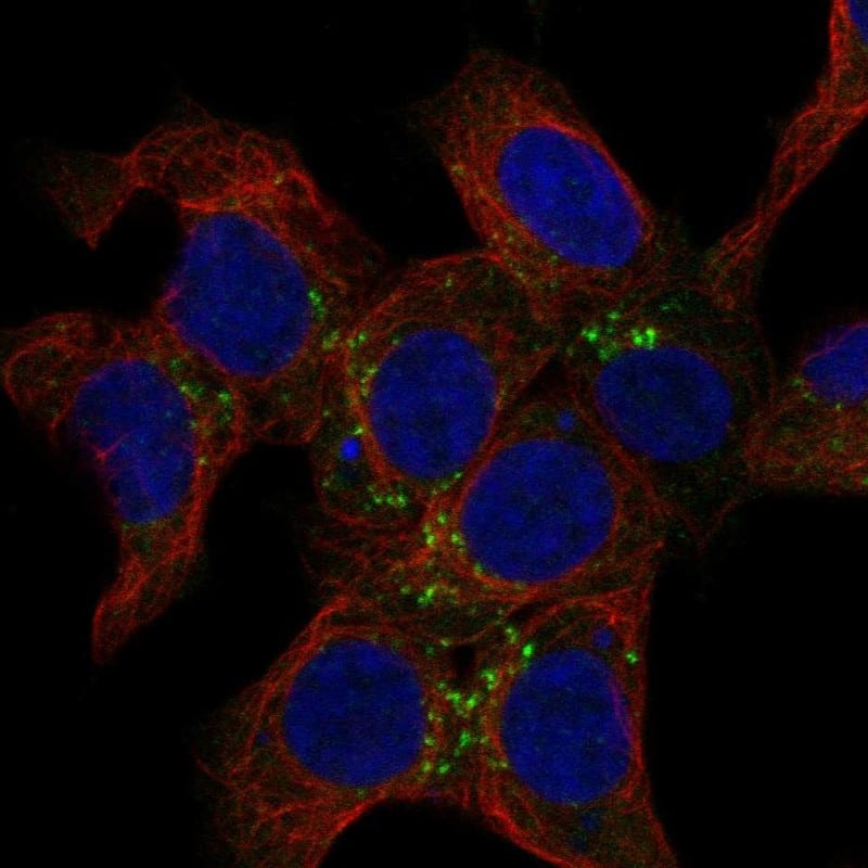 SNX2 Antibody Immunocytochemistry/Immunofluorescence: SNX2 Antibody [NBP3-25150]