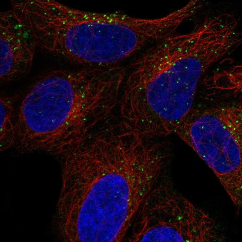 SNX27 Antibody Immunocytochemistry/Immunofluorescence: SNX27 Antibody [NBP3-25151]