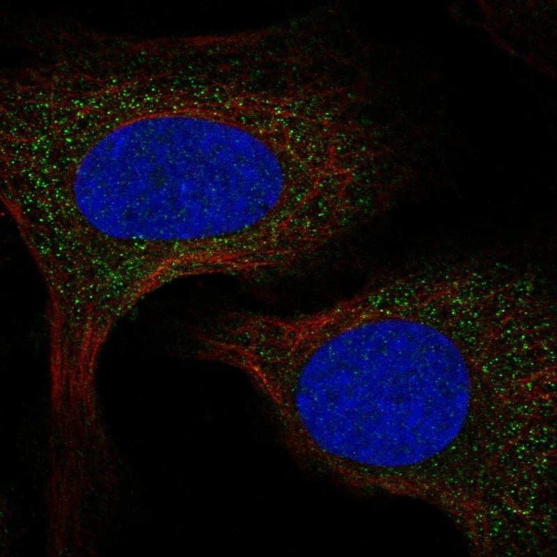 SPCS2 Antibody Immunocytochemistry/Immunofluorescence: SPCS2 Antibody [NBP3-25153]