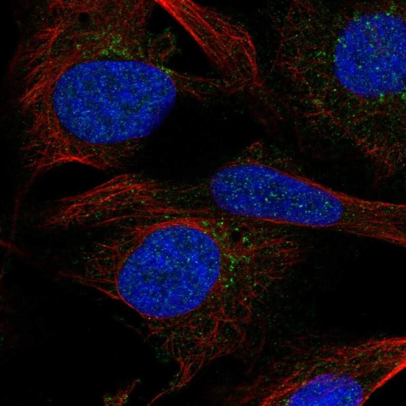 Sphingomyelin Synthase 2 Antibody Immunocytochemistry/Immunofluorescence: Sphingomyelin Synthase 2 Antibody [NBP3-25155]