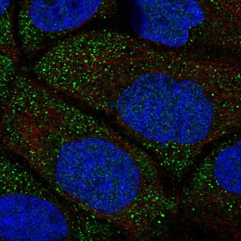 SRRM5 Antibody Immunocytochemistry/Immunofluorescence: SRRM5 Antibody [NBP3-25156]